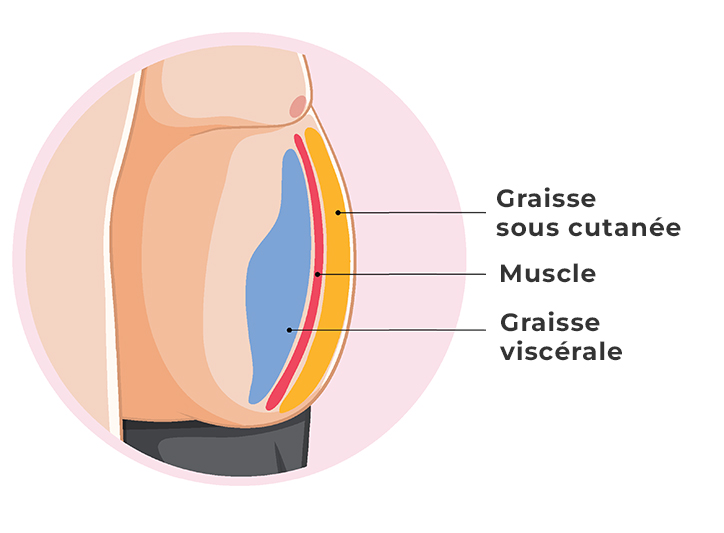 graisse viscérale